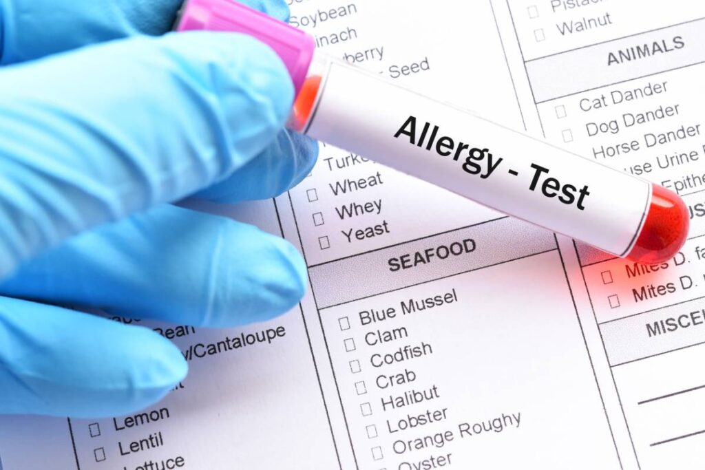 chứng nhận chống dị ứng allergy uk