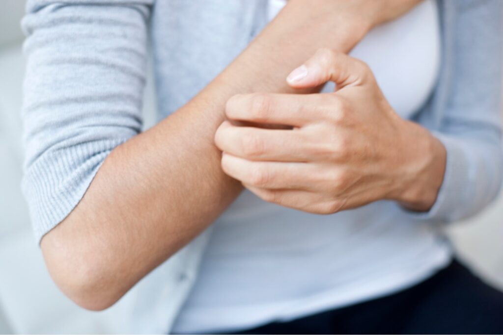 can wet wipes cause rash
